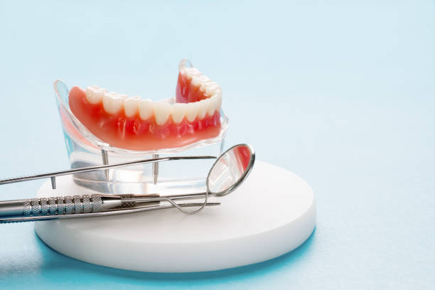 Dental Bonding in Vienna Bend, LA