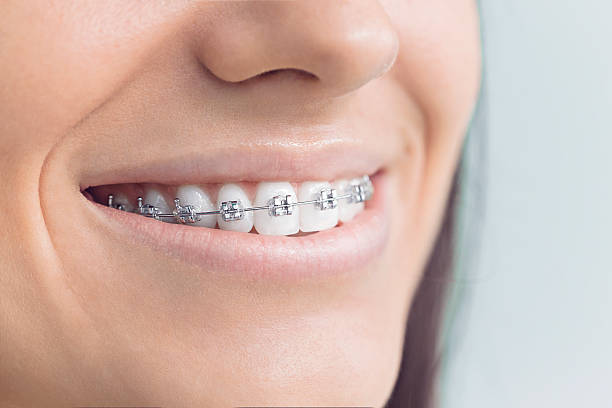 Best Invisalign and Clear Aligners  in Vienna Bend, LA